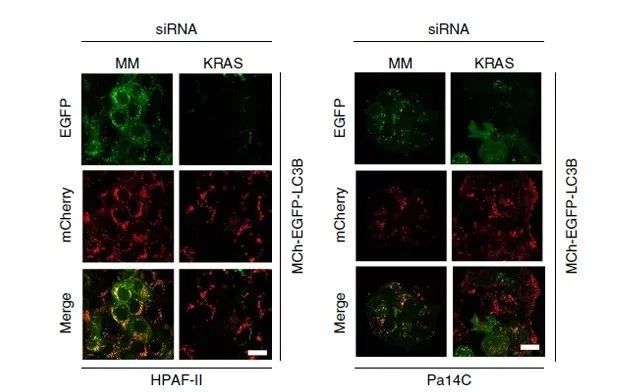 制增加 KRAS 突变 PDAC 细胞系的自噬通量