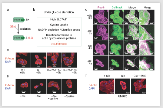 葡萄糖饥饿条件下，异常二硫键形成导致的肌动蛋白动力学