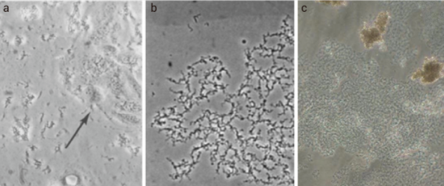 分歧杆菌污染的细胞