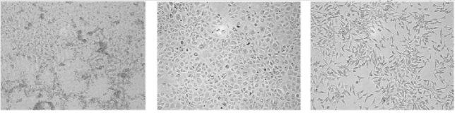 正常细胞与污染的细胞