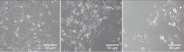 细胞系中支原体污染后细胞形态的变化