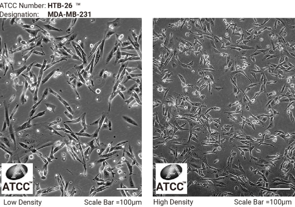 MDA-MB-231 细胞低密度和高密度生长形态
